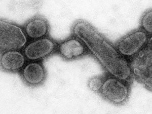 Spanish Flu Virus